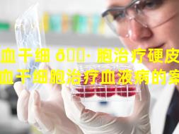 造血干细 🌷 胞治疗硬皮病（用造血干细胞治疗血液病的案例）